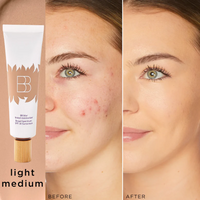 #O3 LIGHT-MEDIUM